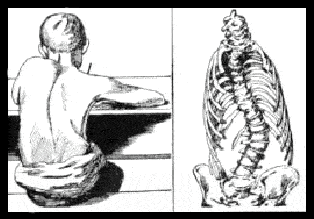Position assise et colonne vertébrale (image Centre Européen de la Colonne Vertébrale)
